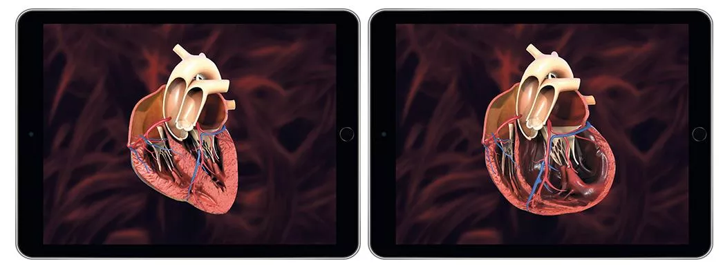 Screen der App Herzstark in 3D