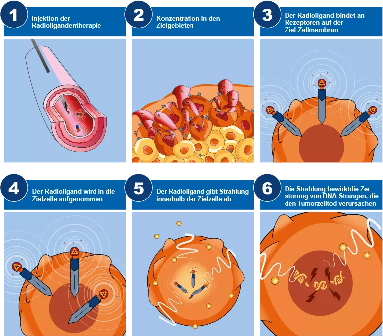 Radiophramazeutika Wie werden Krankheiten durch die Nuklearmedizinische Therapie behandelt Grafik 2